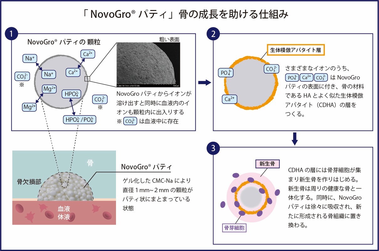 原理の模式図